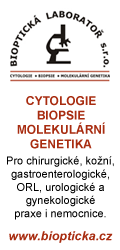 Reklama: Bioptick laborato s.r.o.